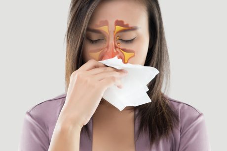woman holding her nose with a tissue